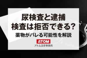 尿検査で薬物の陽性反応が出たら逮捕される?尿検査は拒否できる? 430 尿検査と逮捕|検査は拒否できる?
